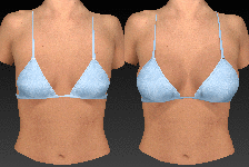 Breast Aug - Blue Bikini - Animation - web