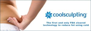 Coolsculpting Woman pinching fat