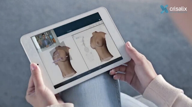 Visualize Your Results Before Your Surgery With 3D Imaging Technology