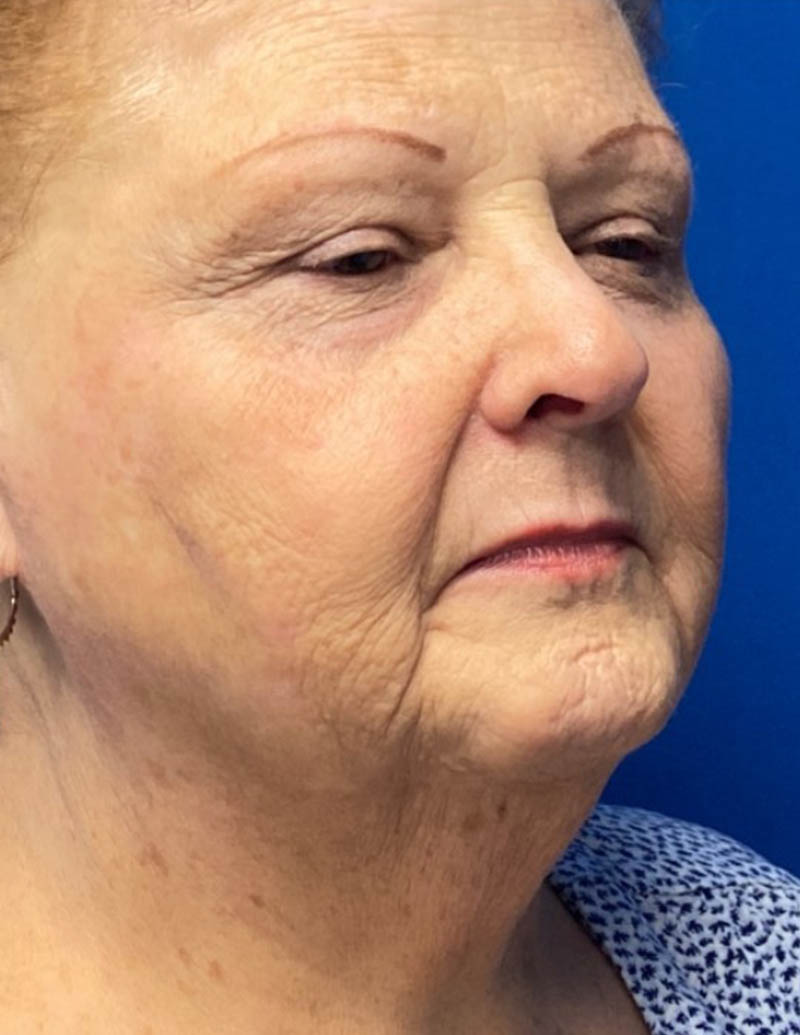 Laser Archives Dr. Rudolf Thompson